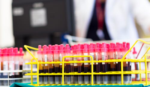 Rack of tubes with blood samples, laboratory technician working in the background.